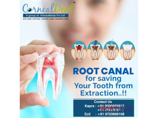 Root Canal Treatment in Hyderabad