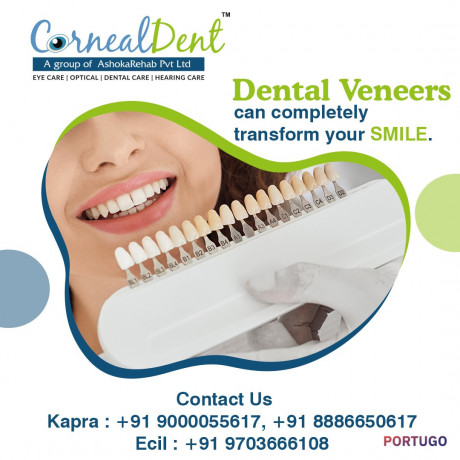 root-canal-treatment-in-hyderabad-big-0