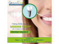 root-canal-treatment-in-hyderabad-small-0